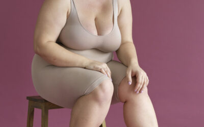 Cos’è il lipedema? Una guida per capire una malattia ancora troppo poco conosciuta